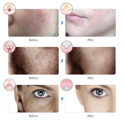 Facial Reset 7-Mode LED Therapy Mask